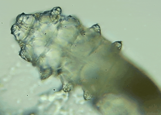 睫毛上驚現(xiàn)80只螨蟲！別揉了，快自查下你的眼睛有沒有......